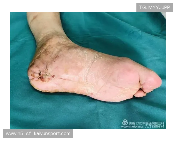 法兰克福引领未来健康新航向：全新康复与营养系统革新亮相